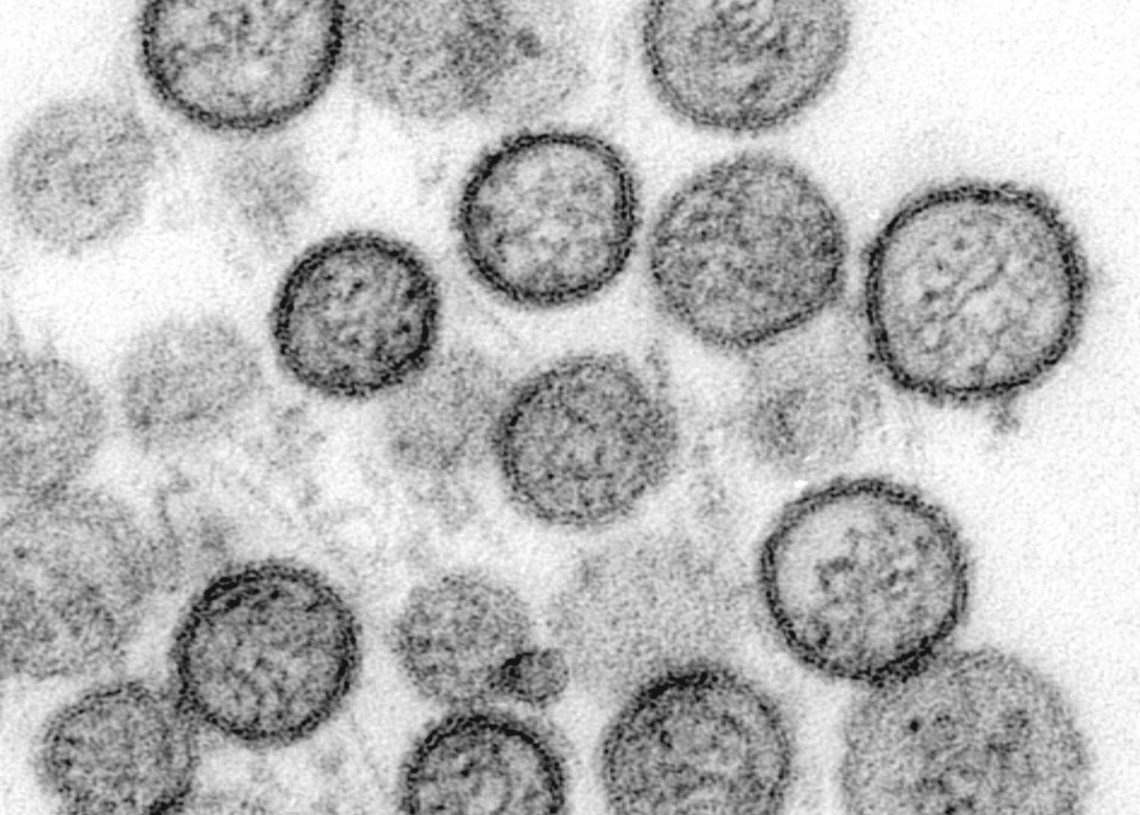 sin nombre virus hanta tem 1137 lores