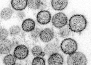 sin nombre virus hanta tem 1137 lores